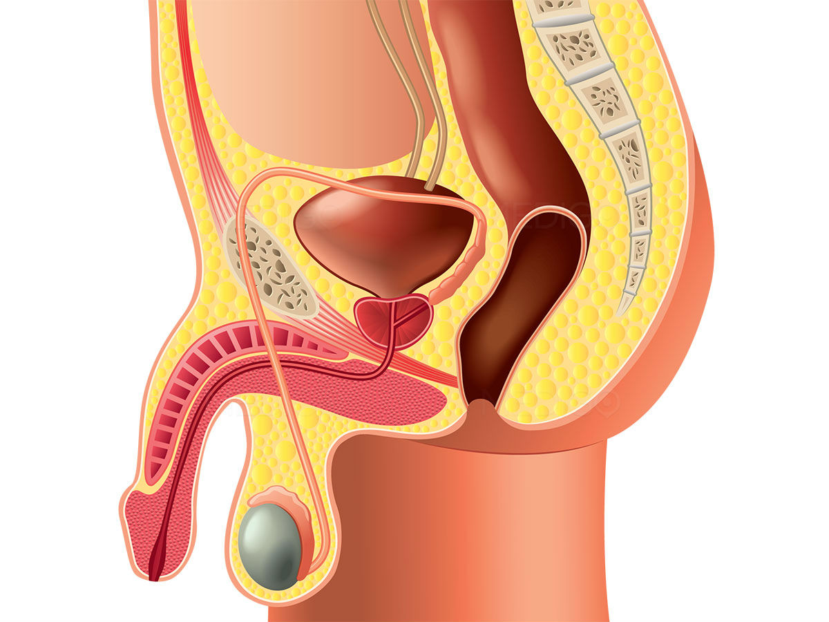 Image phalloplastie médicale ; fin du cauchemar masculin